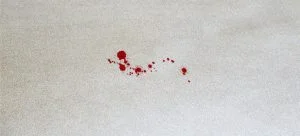 how to get rid of blood stains out of carpet